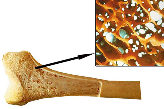 Kemik İliği Nedir ve Faydaları Nelerdir?